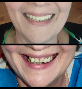 Slider image (2) Dr. Aleksandar Kovacevic - Dental Clinic in Croatia